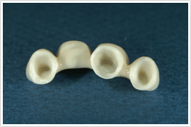 オールセラミック(ジルコニアセラミック)