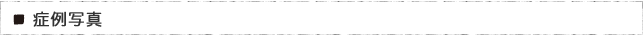 症例写真